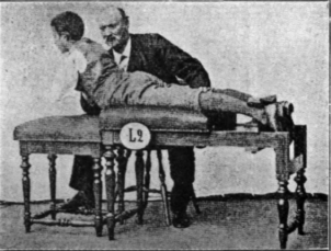 Fig. 173