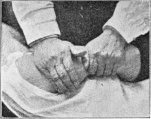 Fig. 18