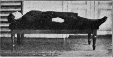 Fig. 36