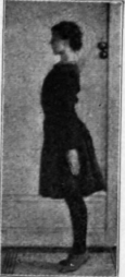 Fig. 38