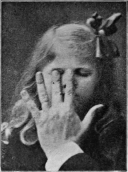 Fig. 9