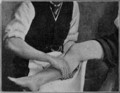 Fig. 10.   Kneading. Second position. Note the relative pronation. The rotation is exaggerated for purposes of reproduction