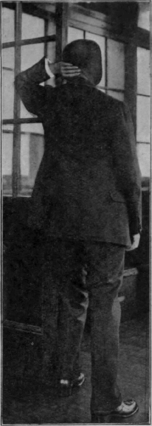 Fig. 102.   Third position when utilising a door to re educate arm movements. The body rotates slightly, and the elbow remains stationary, while the hand falls naturally to the back of the head, which is then extended