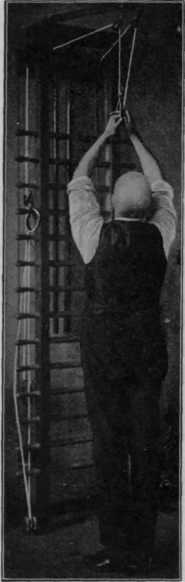 Fig. 103.   An early exercise with the weight and pulley if the left hand is unable to grasp the handle