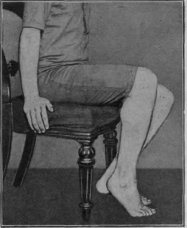 Fig. 108.   The final stage in the first sitting exercise. The heels cannot reach the ground