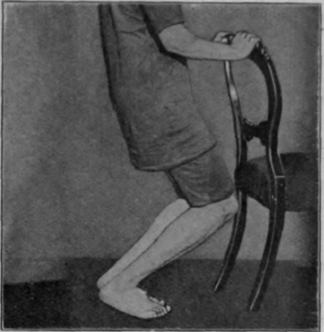 Fig. 114.   To illustrate simple knee bending. Note that the body weight falls on the outer sides of the feet
