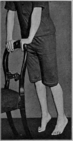 Fig. 119.   The second position in tip toe exercises. The weight of the body has been rolled across the transverse metatarsal arch