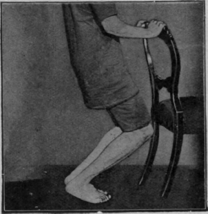 Fig. 122.   The first heel raising knee bending exercise. Note the knees fall directly over the toes. The feet are kept parallel
