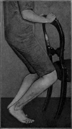 Fig. 123.   The second heel raising knee bending exercise. Note the knees still fall directly over the toes. The feet are at about an angle of 90� to one another