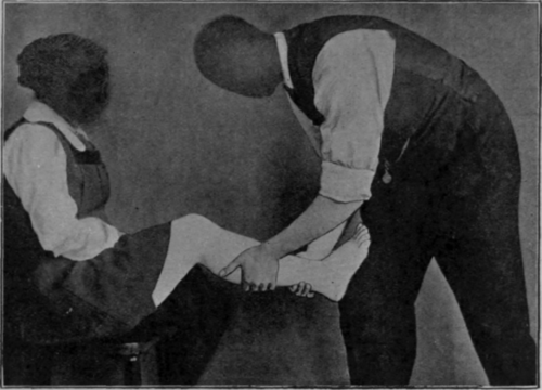 Fig. 125.   To show one method of attempting to stretch the tendo Achillis