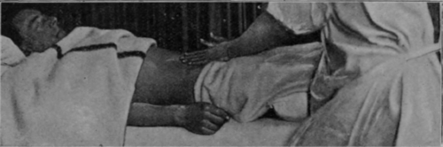 Fig. 128. Stroking the abdomen with both hands. The end of the stroke. It is a very difficult movement to perform rhythmically, and requires much practice. The use of one hand at a time is much more simple