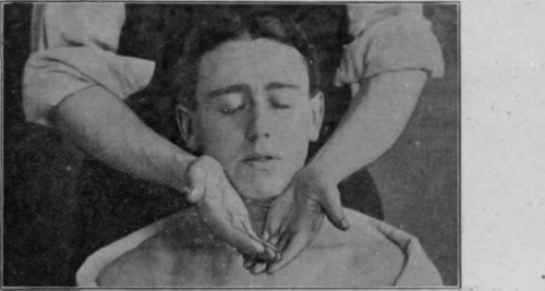Fig. 131.   Stroking the neck: patient sitting. The beginning of the stroke