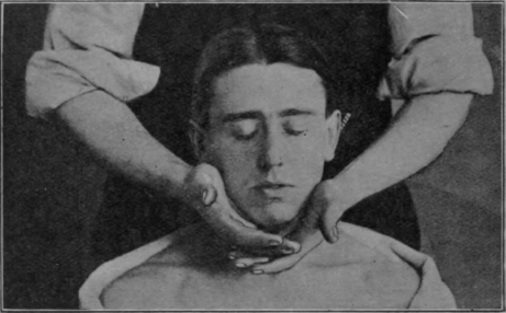 Fig. 132.   Stroking the neck: patient sitting. The middle of the stroke