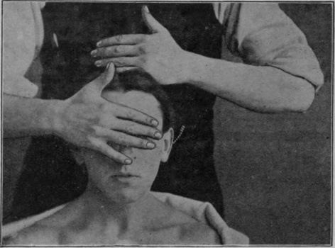 Fig. 137.   Second movement for forehead stroking: patient sitting. The right hand is commencing the movement; the left is just finishing