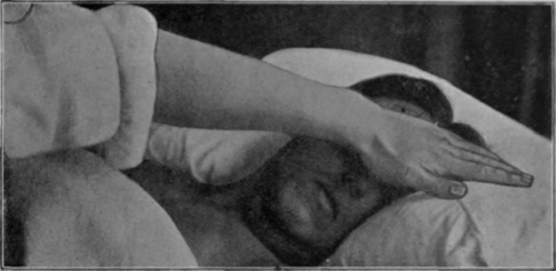 Fig. 138.   Head stroking: patient recumbent. Note position of masseur and patient. The movement begins with the passing of the hand over the pillow. This can be made to produce a slight swishing sound, which, being rhythmically repeated, acts as an additional suggestion via the sense of hearing