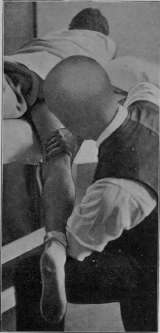 Fig. 146. The end of the movement shown in Fig. 145