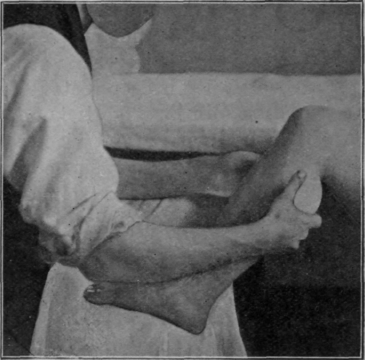 Fig. 15.   Shaking the calf muscles. Note the loose grip, and that both hands can work simultaneously