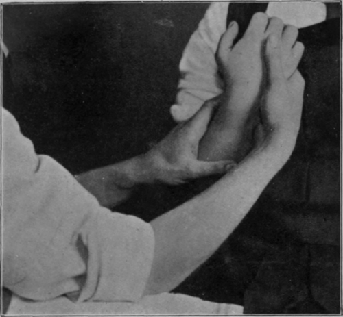 Fig. 22.   To show full supination of forearm with flexion of elbow