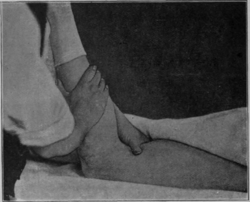 Fig. 34.   Another method of securing flexion of the knee, the thigh being fixed. The masseur should be standing further to the right at the side of the patient, but this could not be shown in the photograph