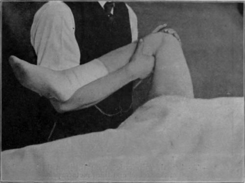 Fig. 35.   To show position for administering movement to the hip The same position is also of service when mobilising the knee