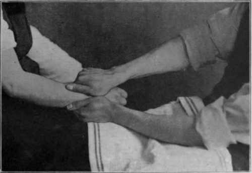 Fig. 36.   To show the grip for lateralising the inferior radioulnar joint