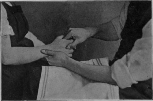 Fig. 37.   To show the grip for loosening the joints between the bases of the second and third metacarpals