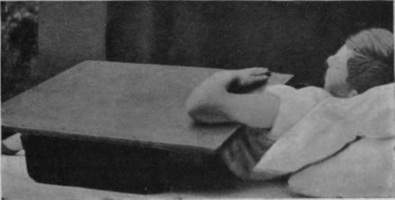 Fig. 44. To show the starting position for free extension of the elbow. This is also the end position of free flexion