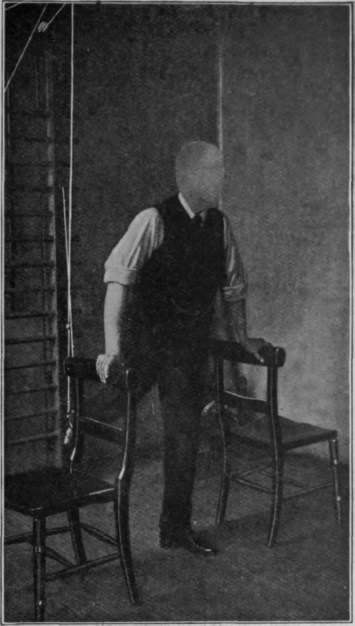 Fig. 56.   To show resistive exercise for the flexors of the hip. The extensors receive assistive exercise, and there is also some resistive exercise given to the quadriceps
