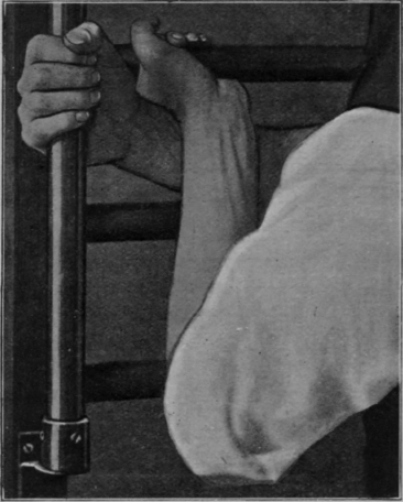 Fig. 69.   A useful exercise for securing full extension of the wrist by the aid of the ladder. The left elbow is raised and lowered