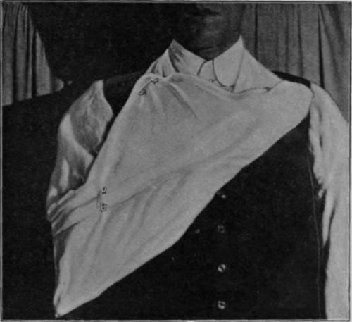 Fig. 77.   To show flexion by a sling