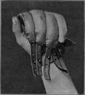 Fig. 96. To show flexion of fingers by constant tension, the hand being placed in a glove