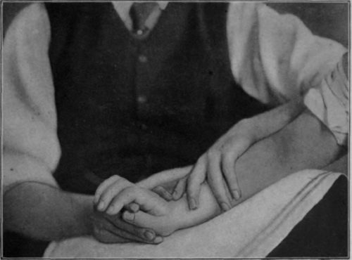 Fig. i8.   Showing the position in full extension of the wrist. The forearm is pronated and fingers are flexed