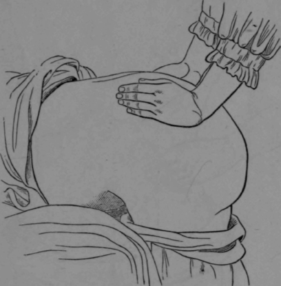 Fig. 16. Stroking of the Glutei.