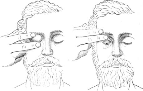 Fig. 22.   Massage of the Eye.