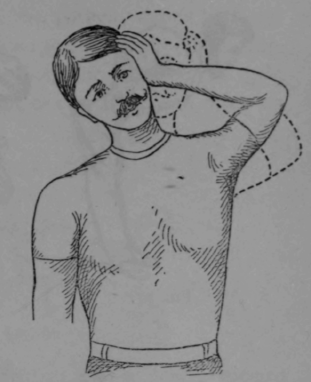 Fig. 74.