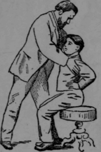 Fig. 97.