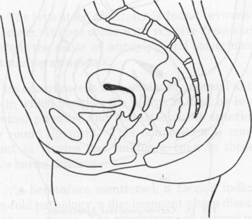 Fig. 16. Cervical Anteflexion.