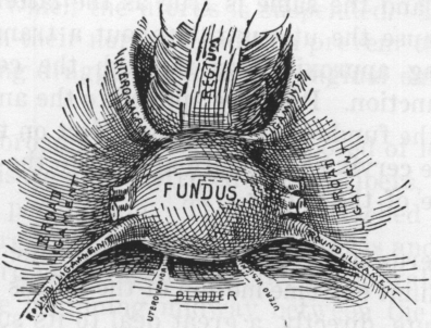 Fig. 2. Uterine Ligaments, Showing Them All on Same Plane. (Gilliam, A Text Book of Practical Gynecology.)