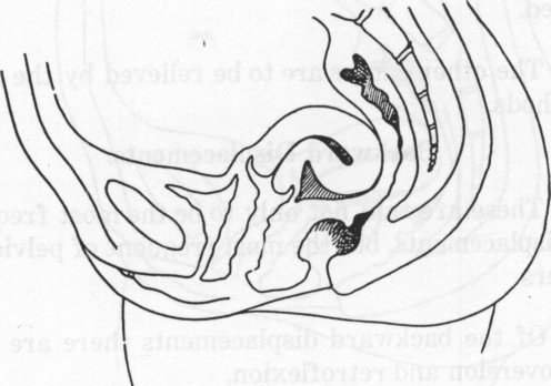 Fig. 27. Retroflexion.