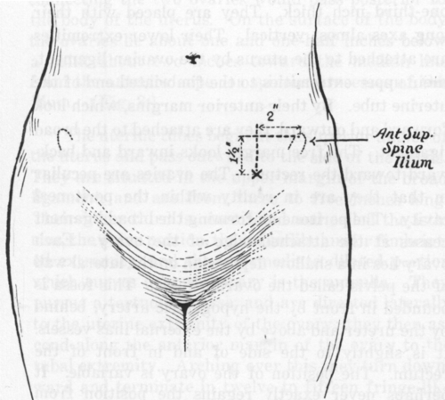 Fig. 3. Surface Location of Ovaries.