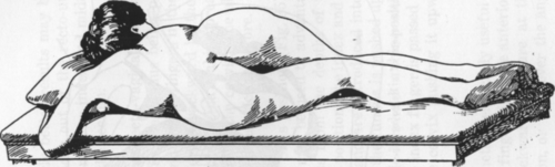 Fig. 35. Sim's or Left Lateral Position.
