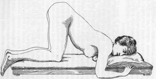Fig. 40. Knee chest Posture.