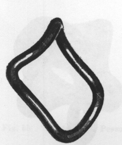 Fig. 47. Hodge Pessary.