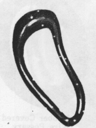 Fig. 49. Thomas Pessary.