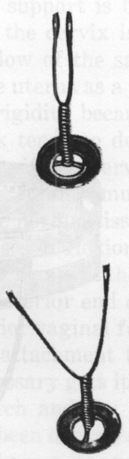 Fig. 65. Gold Stem Pessary. Closed with gelatine capsule for introduction and opened after introduction.