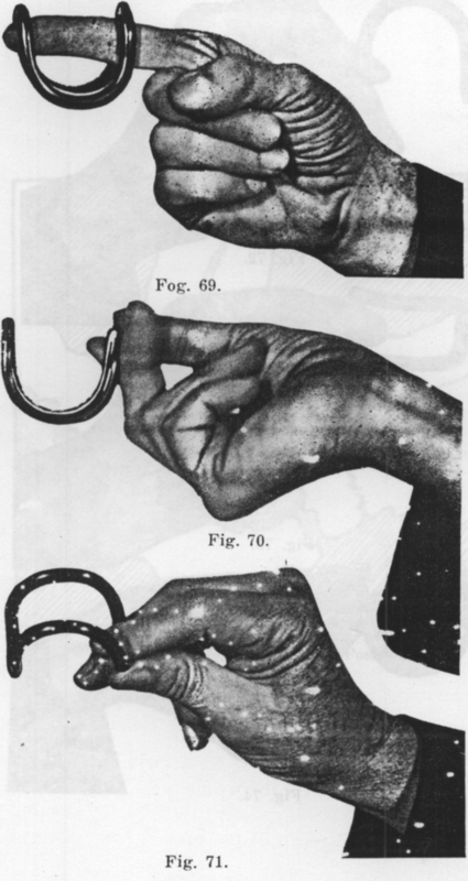 Fig. 69 71. How to insert Gehrung Pessary