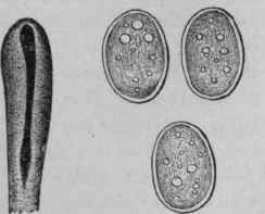 Head of Bothriocephalus Latus. Magnified