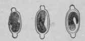 Ova of Trichocephalus Dispar in Process of Development.