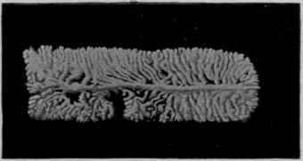 The Uterus and its Branches in a Segment of Taenia Saginata