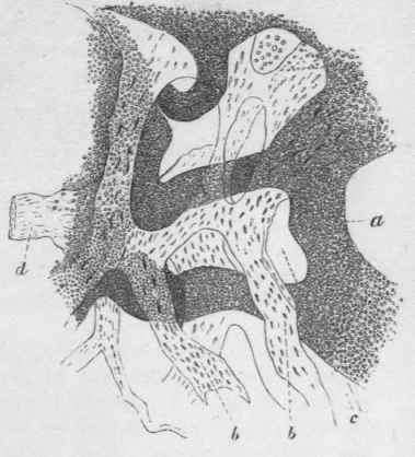 stages of the development of medullary carcinoma
